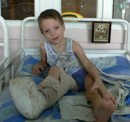 санаторий боброва алупка